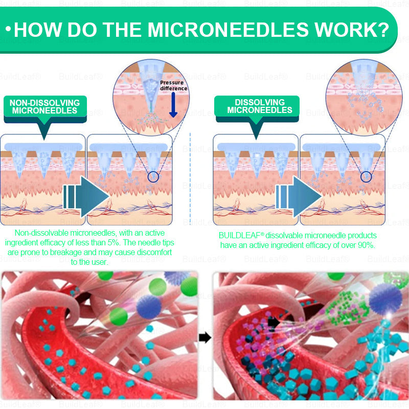 Official Store🏥🏥 | BuildLeaf® GLP-1 Nano-Microneedle Patch with Collagen & Matrixyl 3000 丨Obesity,Cardiovascular Diseas, Diabetes, Sleep Apnea, Joint Problems and More