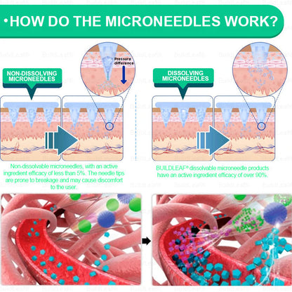 Official Store🏥🏥 | BuildLeaf® GLP-1 Nano-Microneedle Patch with Collagen & Matrixyl 3000 丨Obesity,Cardiovascular Diseas, Diabetes, Sleep Apnea, Joint Problems and More